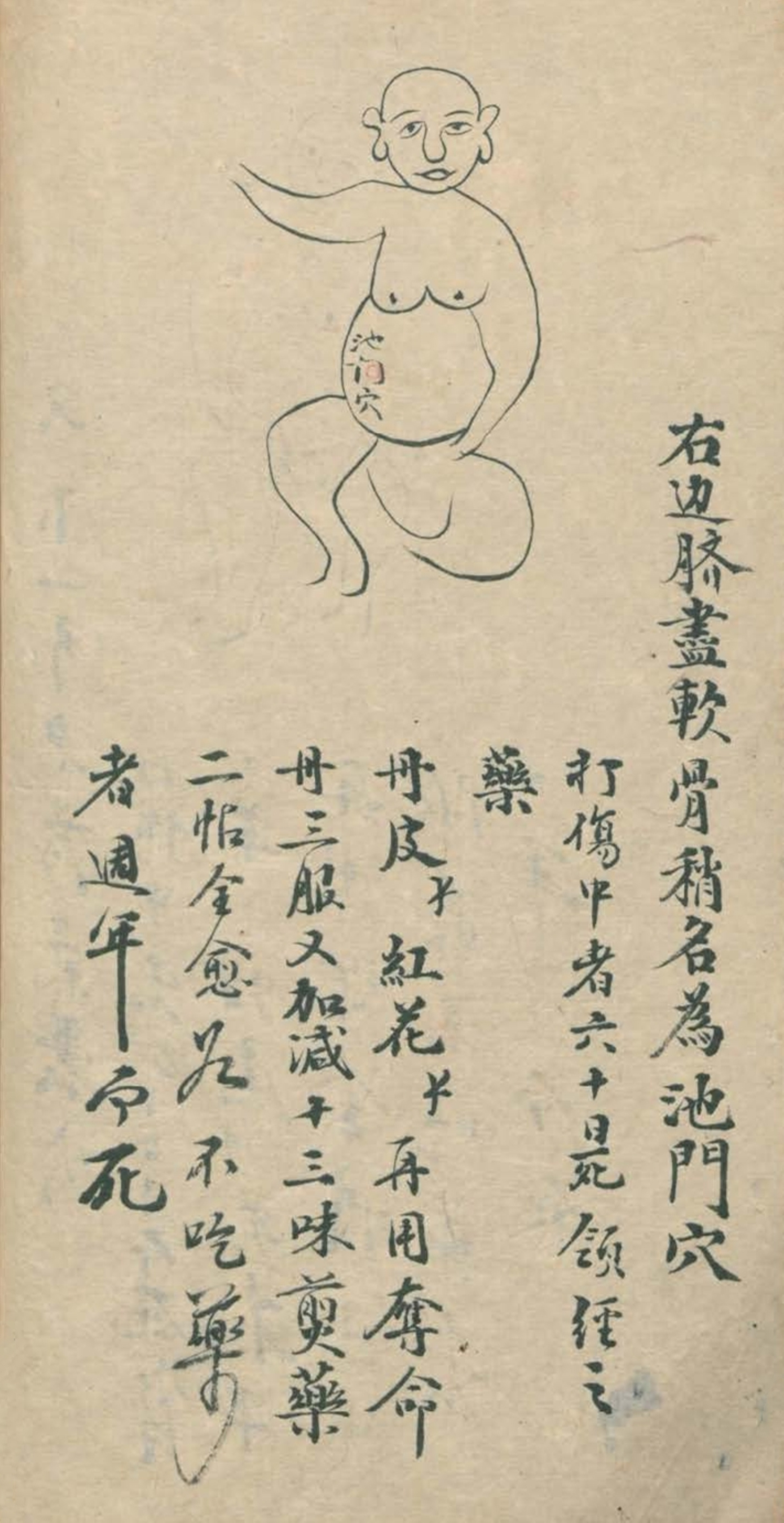 最实用的跌打药方,祖传跌打秘方100首