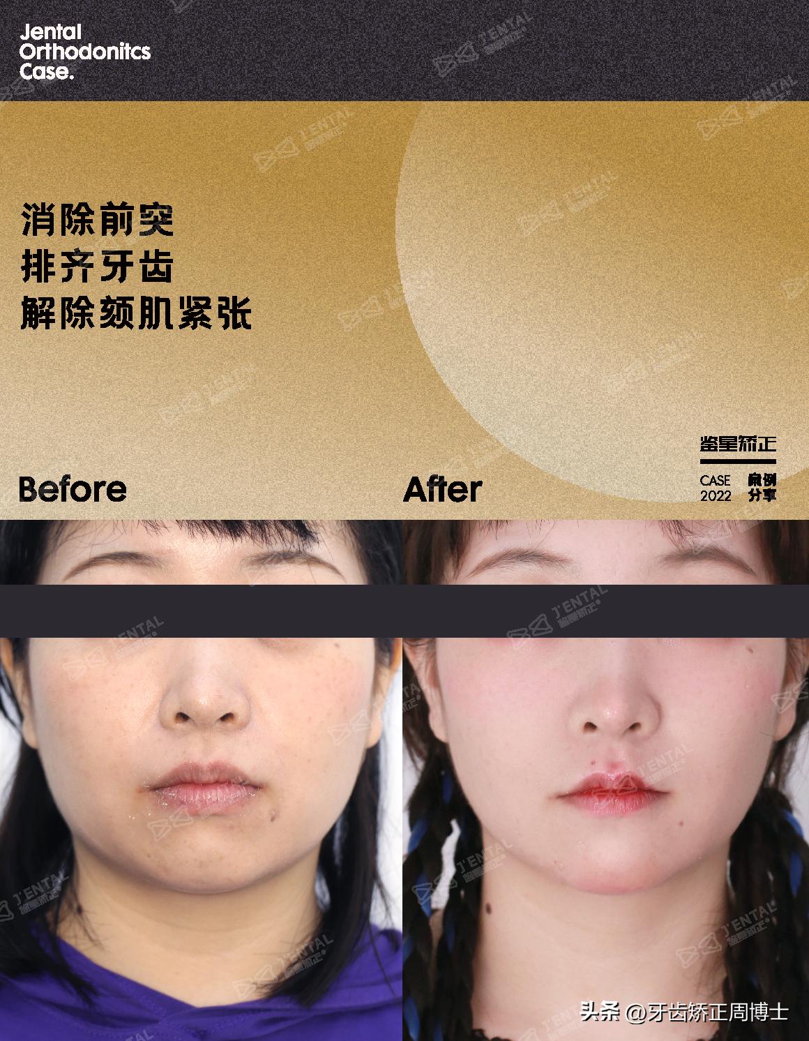 <html>
<head><title>502BadGateway</title></head>
<body>
<center><h1>502BadGateway</h1></center>
<hr><center>nginx</center>
</body>
</html>
<!--apaddingtodisableMSIEandChromefriendlyerrorpage-->
<!--apaddingtodisableMSIEandChromefriendlyerrorpage-->
<!--apaddingtodisableMSIEandChromefriendlyerrorpage-->
<!--apaddingtodisableMSIEandChromefriendlyerrorpage-->
<!--apaddingtodisableMSIEandChromefriendlyerrorpage-->
<!--apaddingtodisableMSIEandChromefriendlyerrorpage-->
