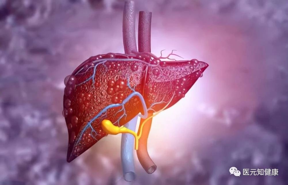 小便像黄豆油黄是怎么回事,小便发黄还有黄渣怎么回事