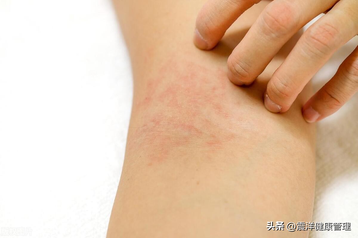 为什么女人有点皮肤瘙痒,女性那里痒是什么原因