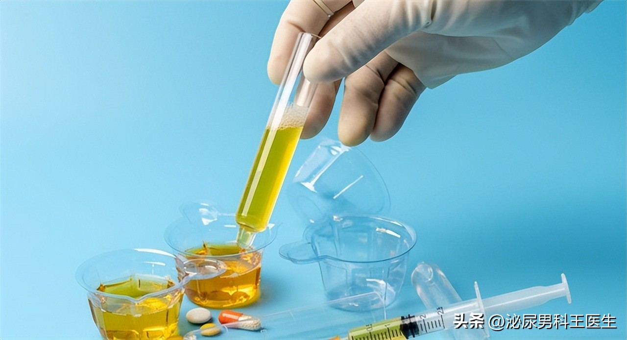 排尿很黄、异味很大？身体向你暗示的这3件事，可能与疾病有关