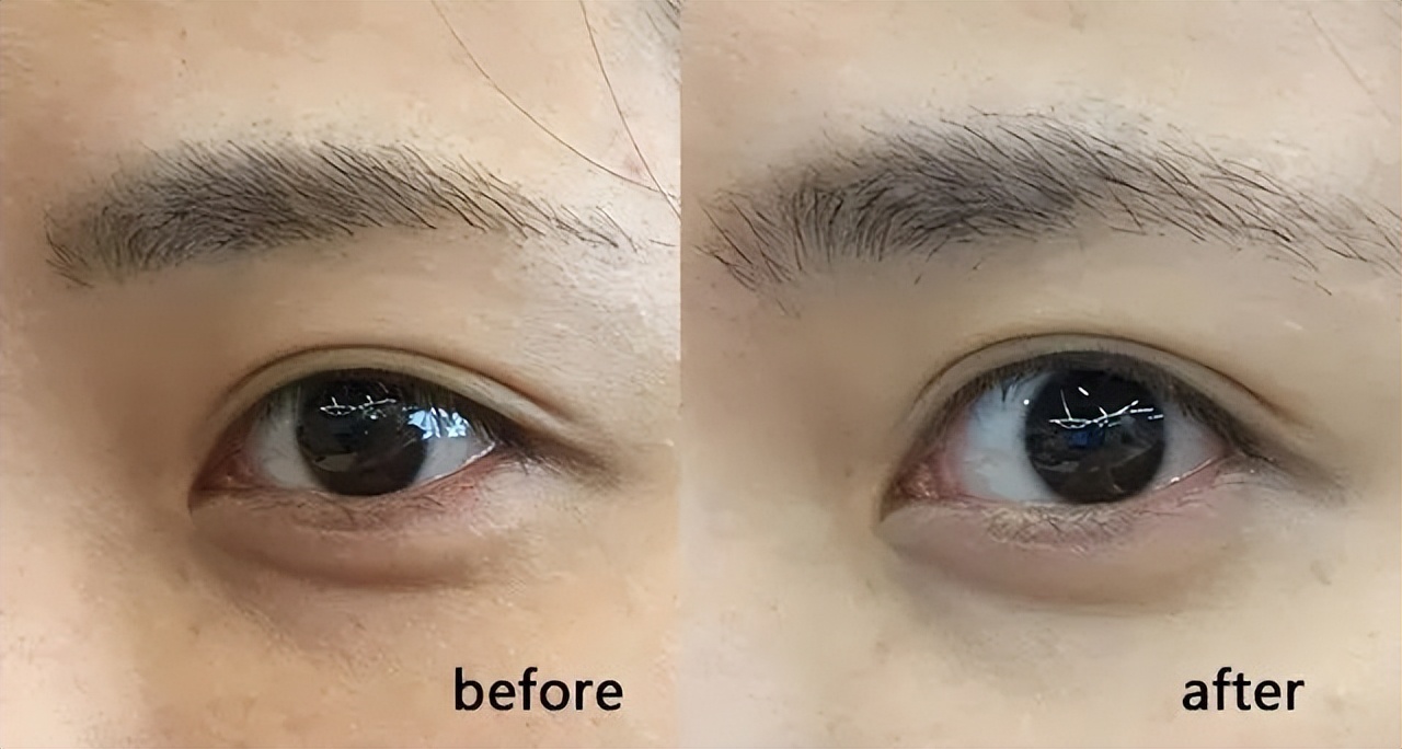 lamer海蓝之谜新生活肤精华油30ml,海蓝之谜焕活精华油适合油痘肌吗