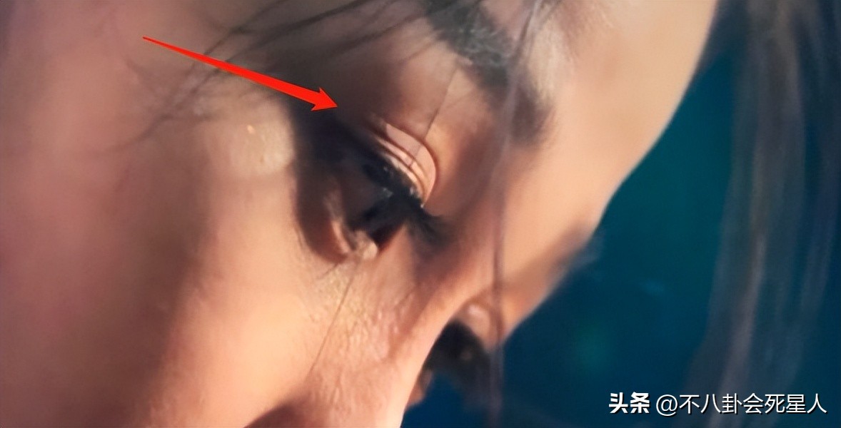 假双眼皮的明星,明星的假脸