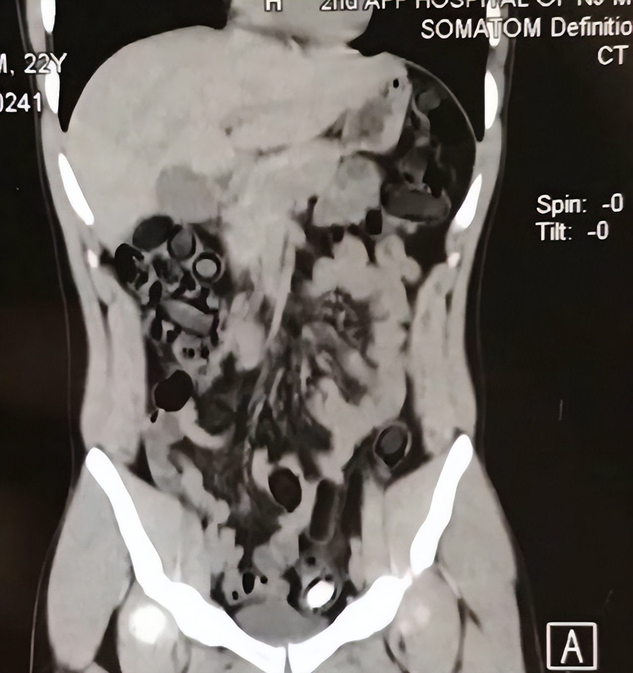 吸毒男得影帝,吸毒明星的复出和缉毒警的关系