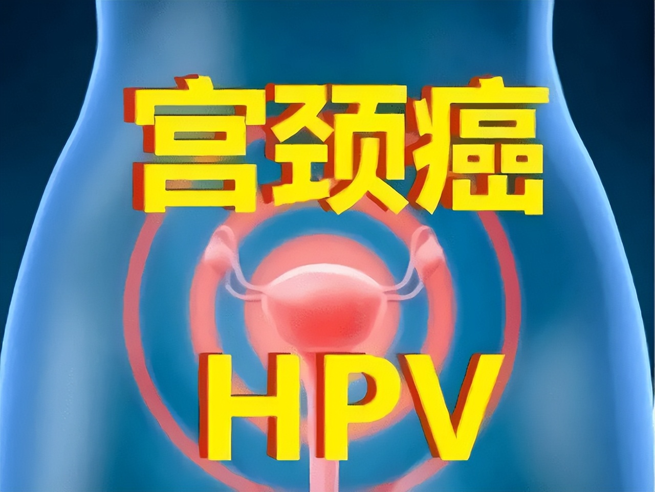 宫颈癌是“拖”出来的？病情若进展到中晚期，女人或出现3个异常