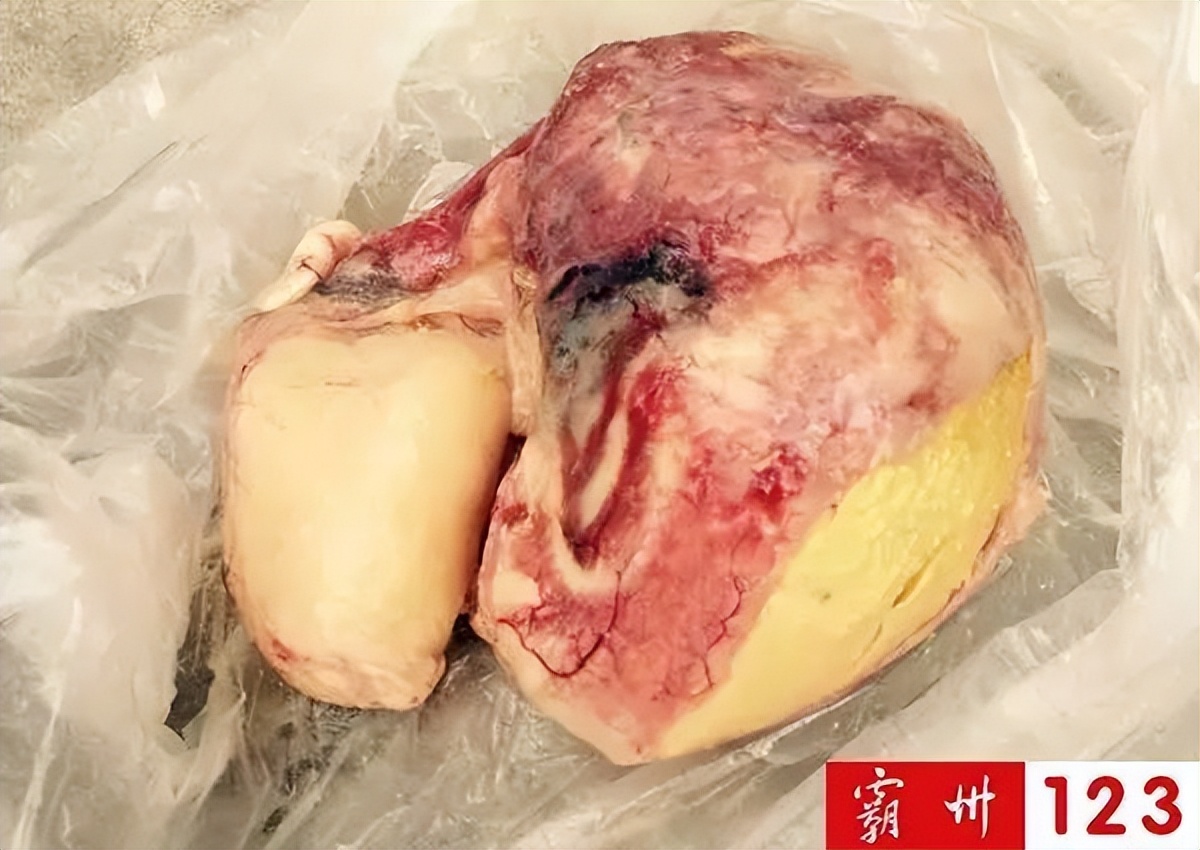 值钱?霸州村民宰鸡发现金黄色“鸡宝”?快来看看