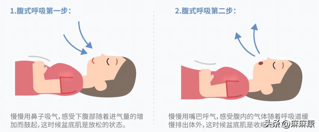 盆底肌紧张慢性盆腔痛,憋不住小便的时候盆底肌疼