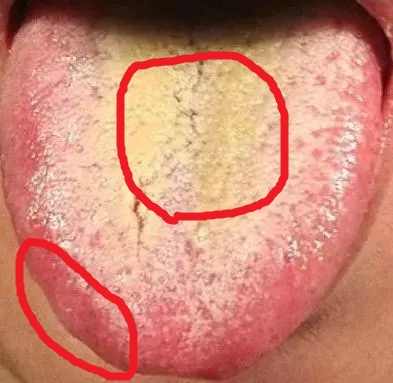 经常喝酒，皮肤痒、阴部潮湿、舌苔黄厚腻？用好这个方