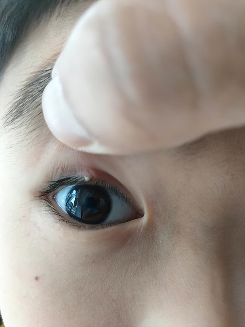 儿童麦粒肿是什么原因起的,儿童麦粒肿是什么原因造成