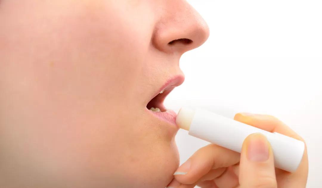 嘴唇干裂起皮不能用舌头舔,唇部一直干裂是怎么回事