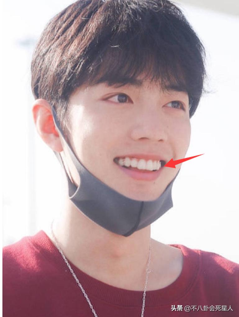 戴牙套是双刃剑：毛不易拯救一口烂牙，刘雯、肖战却变难看了