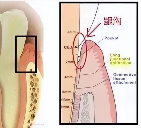 冲牙器和电动牙刷哪个效果好视频,电动牙刷冲牙器对比
