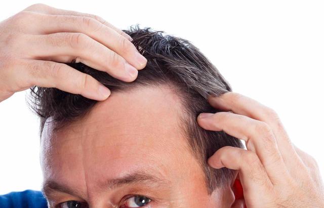 长白头发对我们的健康来说是一件好事？不妨听听哈佛研究怎么说的