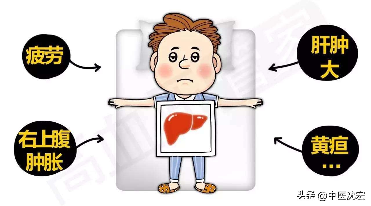 脾胃虚寒脂肪肝中成药,针对脂肪肝的中药