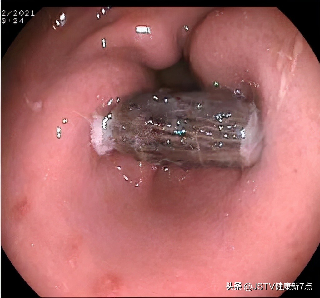 腹痛不止可能是什么原因,腹痛不舒服是什么症状