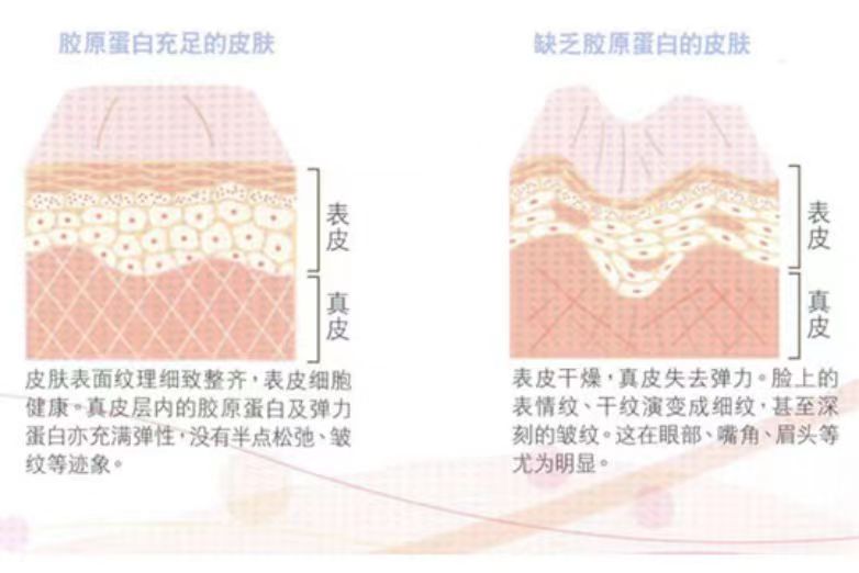 江中胶原蛋白肽是不是智商税,fancl胶原蛋白是智商税吗