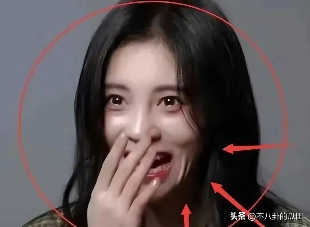 蔡徐坤下巴太尖惹争议图片,蔡徐坤下巴是假体吗