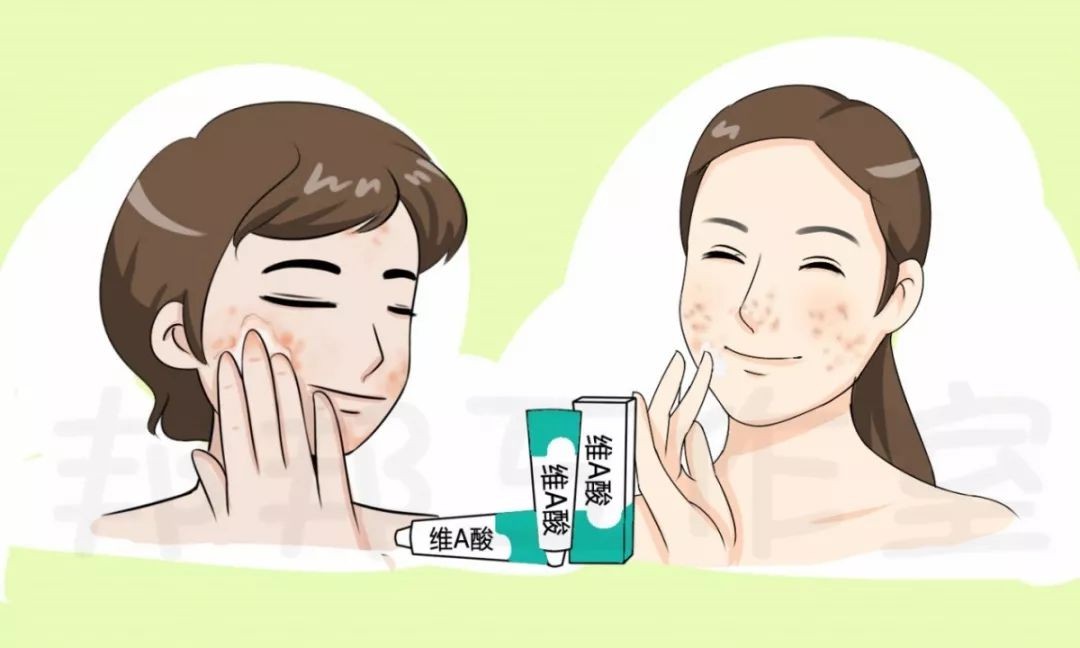 维a酸乳膏祛痘印效果好不好,维a酸乳膏搭配什么祛痘印效果好