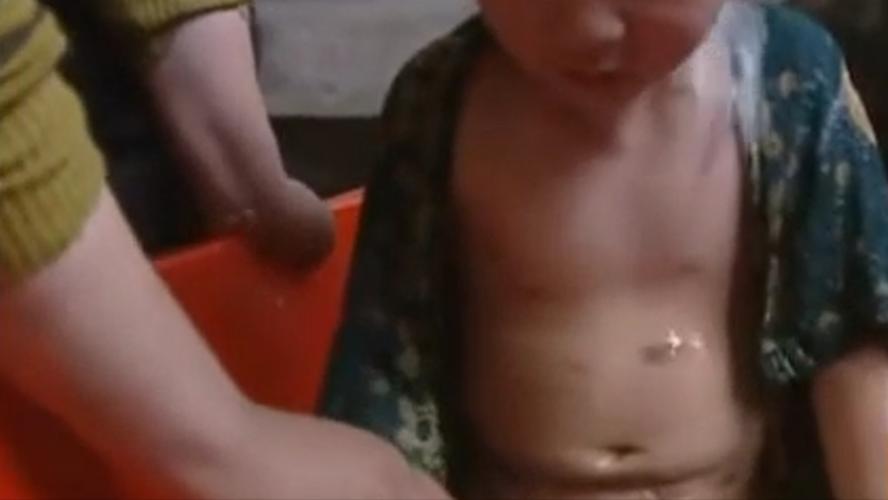 割皮救子父亲康复情况,儿子刚出生为弟弟捐骨髓后续