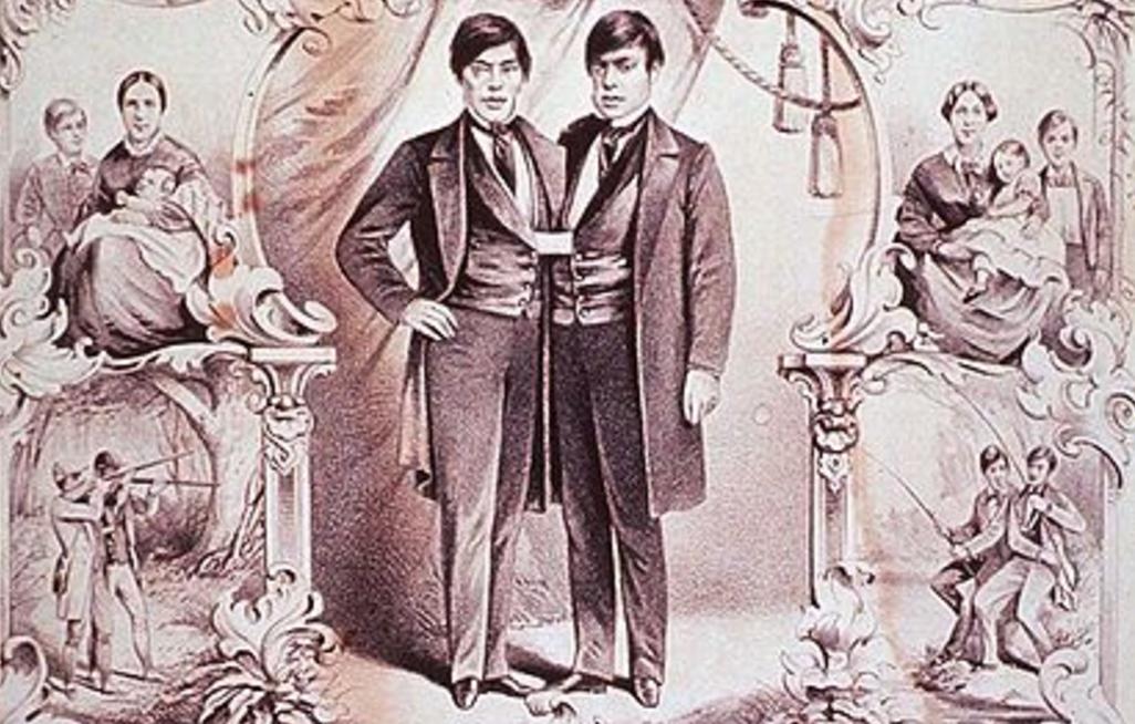 泰国连体人邦克,连体人结婚生子