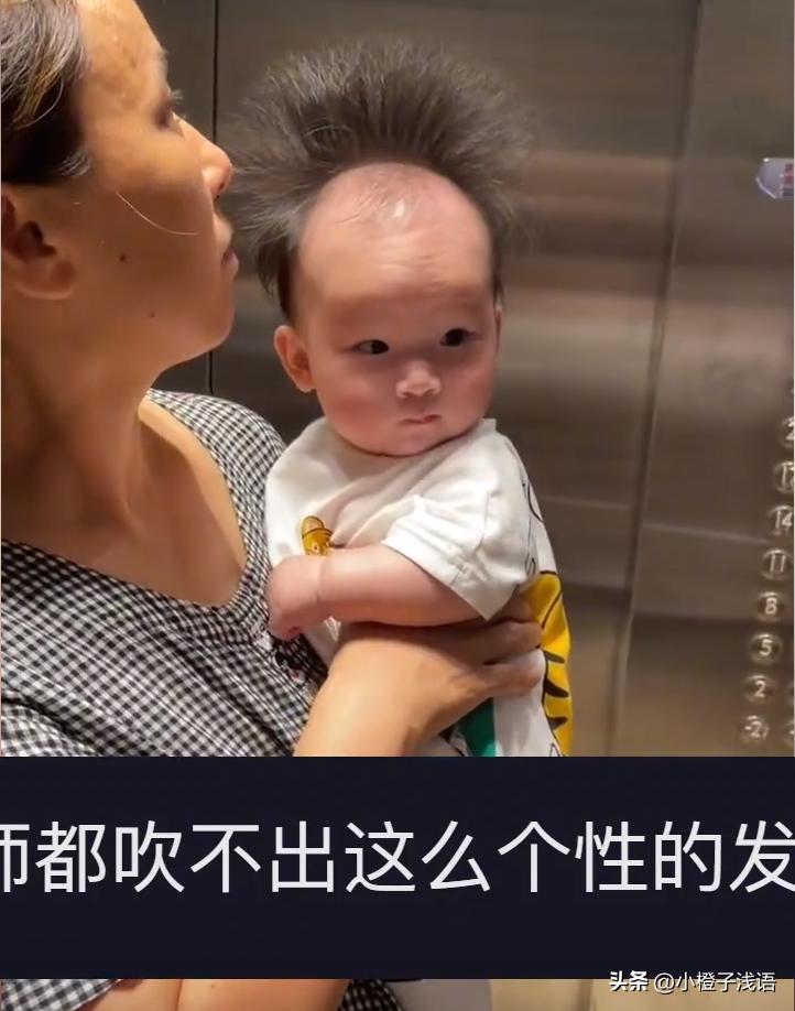幼儿头发秃顶,幼儿前额秃顶