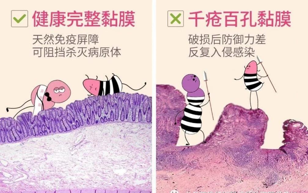 阴道黏膜，比你想象的更脆弱！