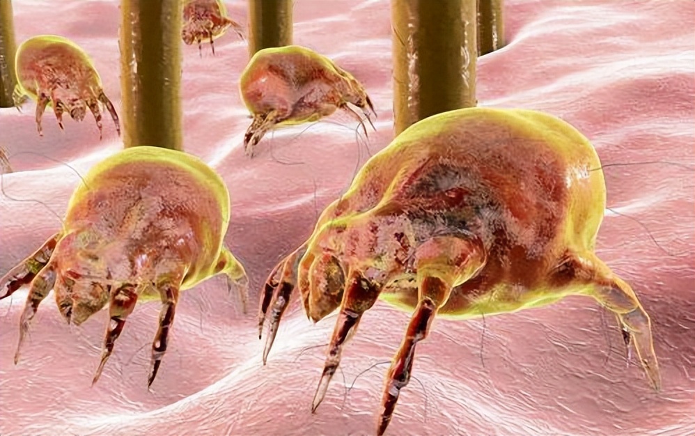 湖南校花坚持用硫磺皂洗头,用硫磺皂洗澡坚持了一年