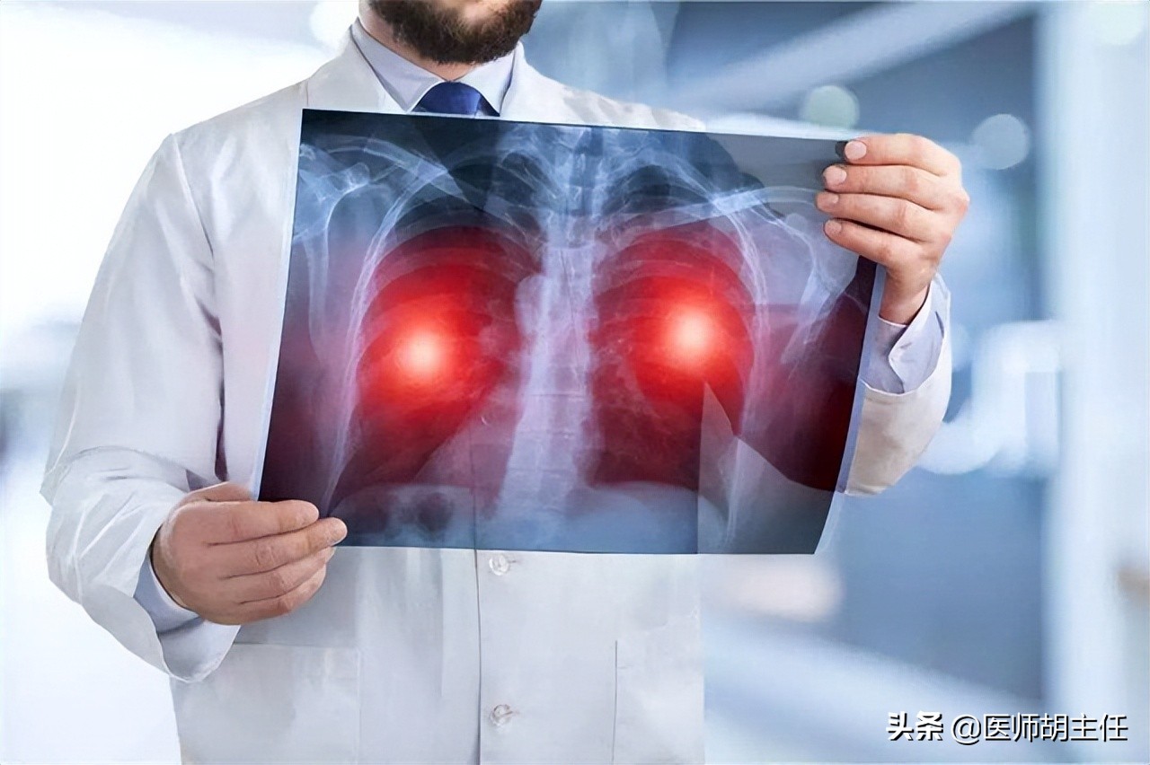 肺癌导致的肩膀疼是什么症状,肺癌导致肩膀疼痛的症状