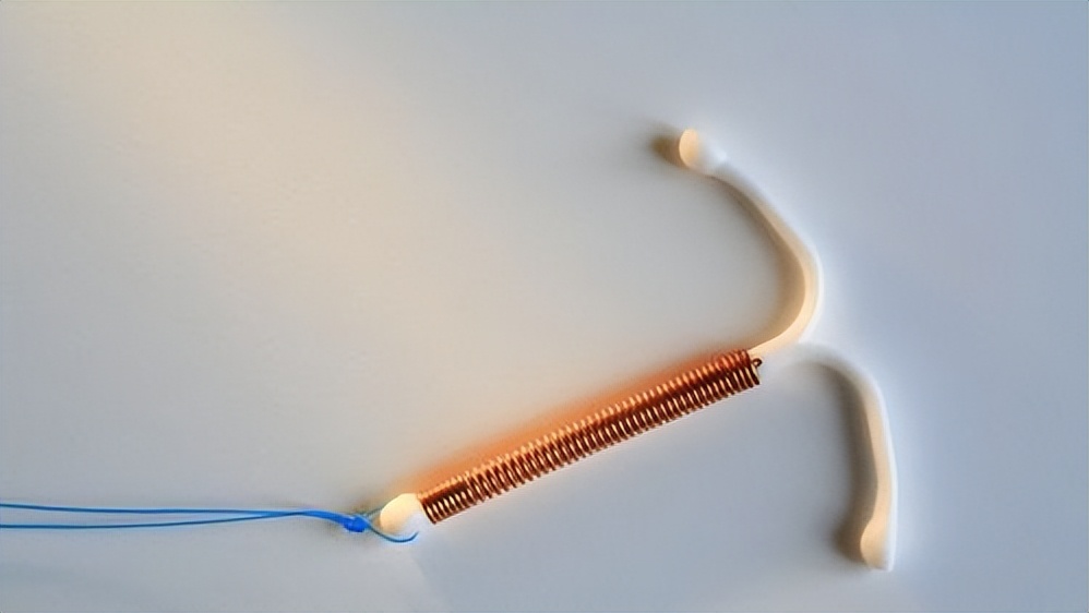 节育环不取能怀孕吗,节育环长肉里了要不要取出来