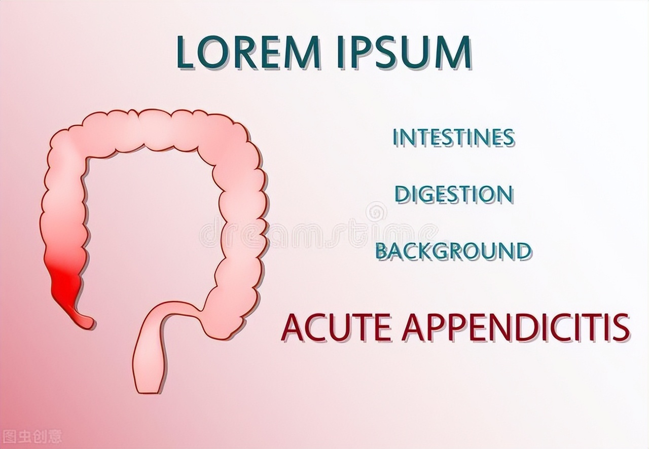 得了阑尾炎怎么办还能减肥吗,古人得了阑尾炎