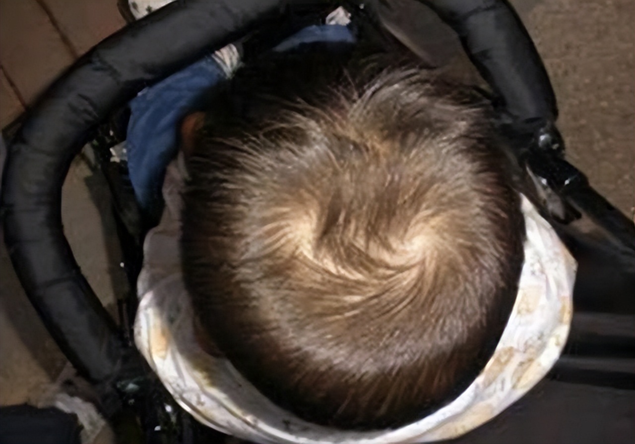 孩子头上的旋代表什么,小孩头顶的旋很重有什么寓意