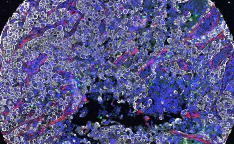 关于癌症科学家研究出的新药品,最新科研进展nk免疫细胞治疗癌症