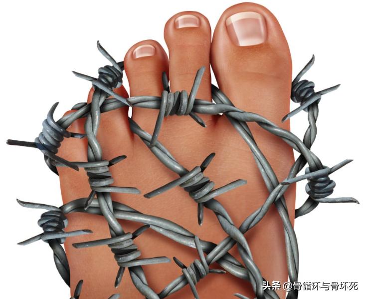 非布司他是不是最好的痛风药,非布司他痛风病人吃得好吗