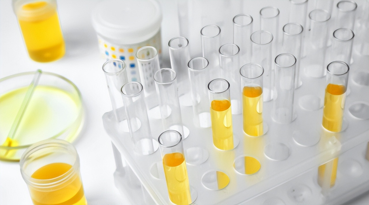 糖尿病肾病患者使用口服降糖药,治疗肾病降尿蛋白效果比较好的药