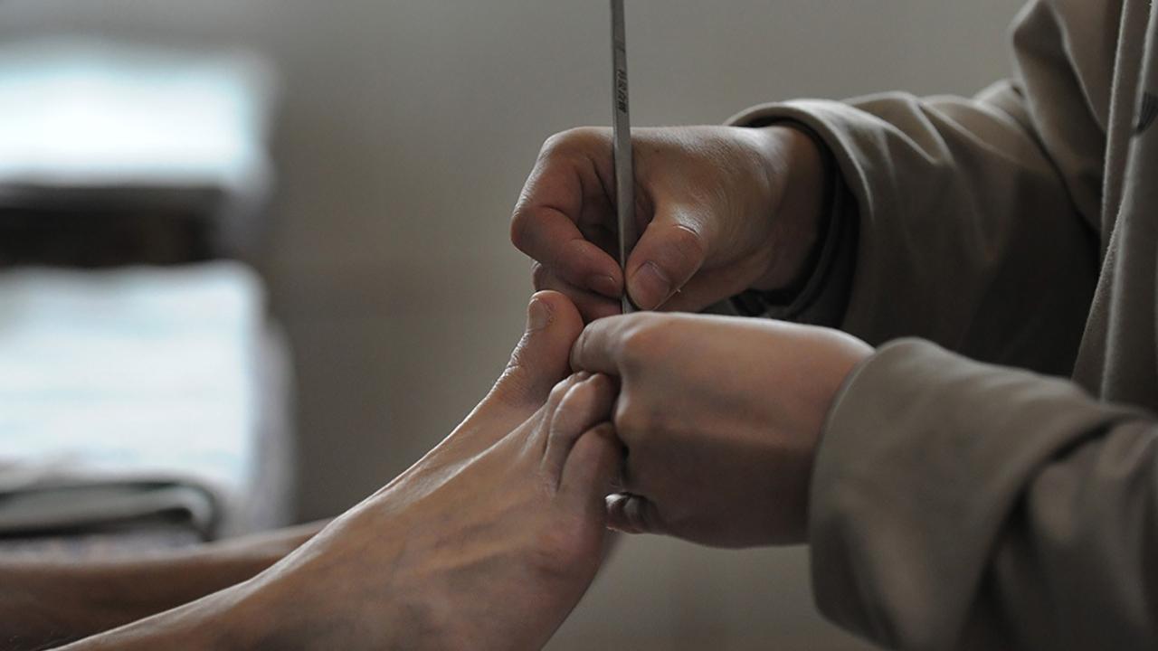 脚底板爱紫是什么原因,脚底板爱起皮是怎么回事