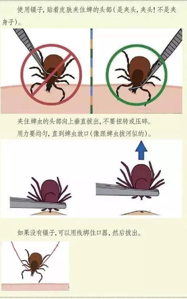 被毒虫咬后需谨慎,被毒虫咬后的有效处理