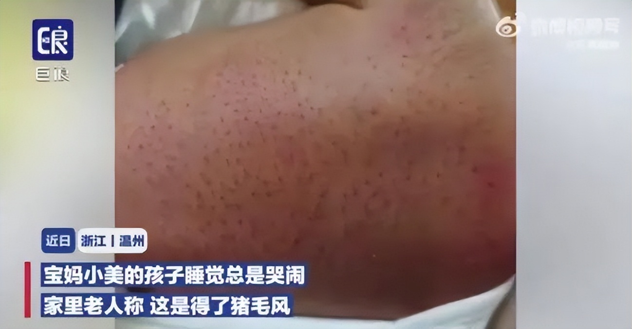 妈妈信偏方害弟弟,妈妈信偏方致宝宝生病