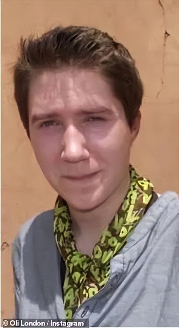 白人网红沉迷Kpop文化，狂整容还做丁丁缩小术，被韩国人骂至道歉