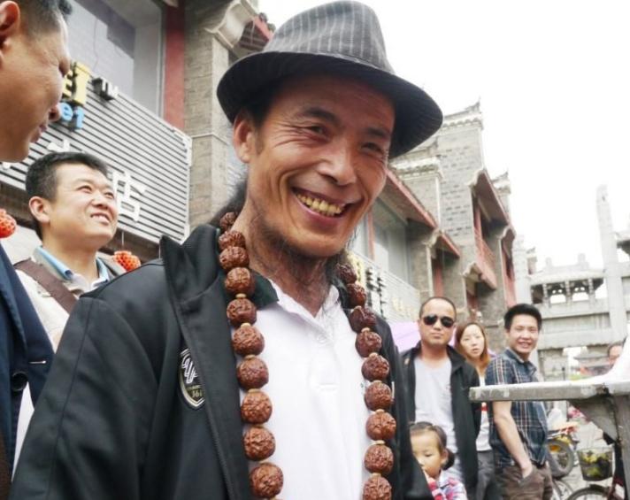 天下第一疯谢建光行走路线,天下第一疯谢建光得了什么病