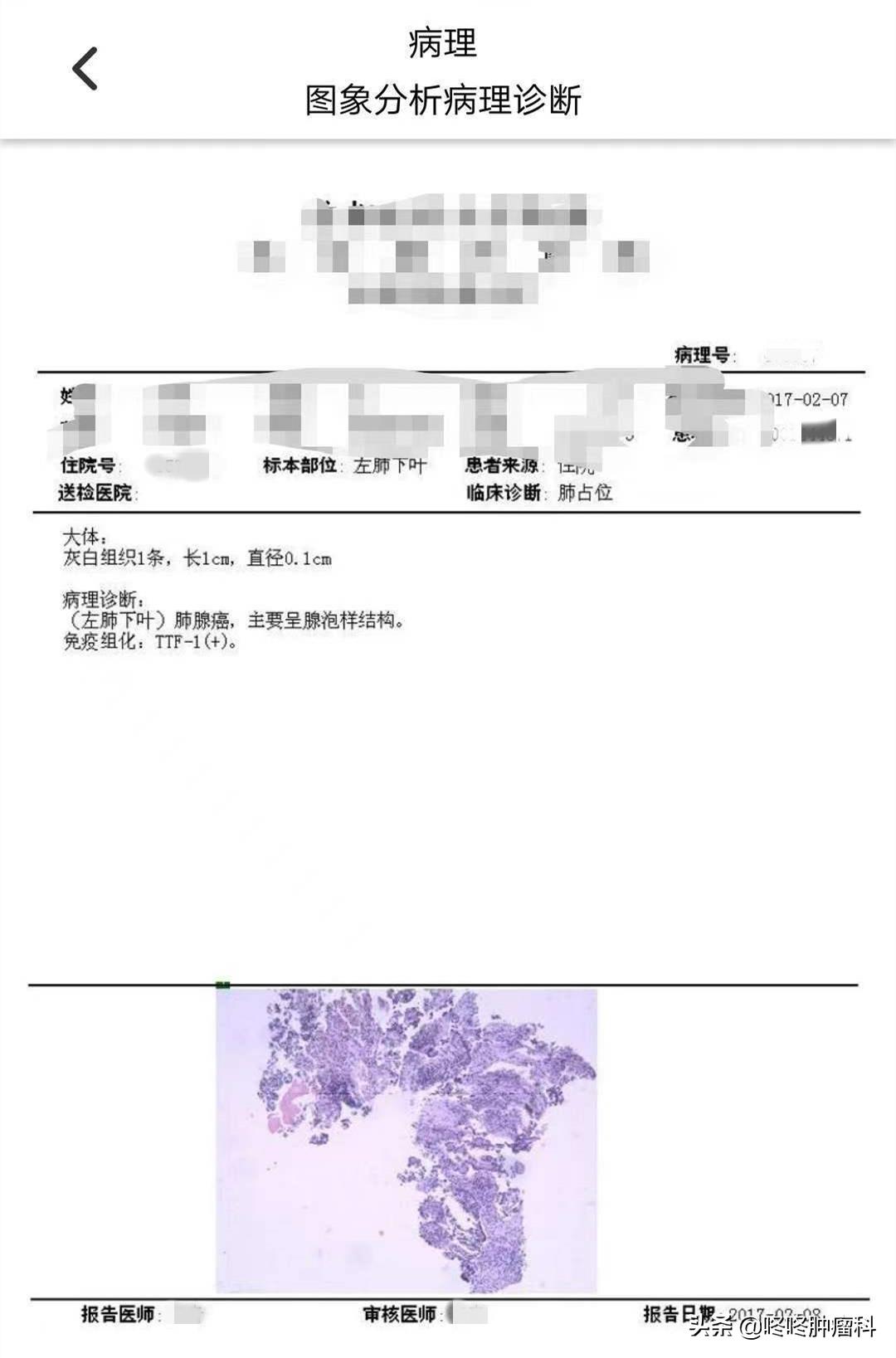抗癌5年化疗16次,抗癌4年战胜病魔