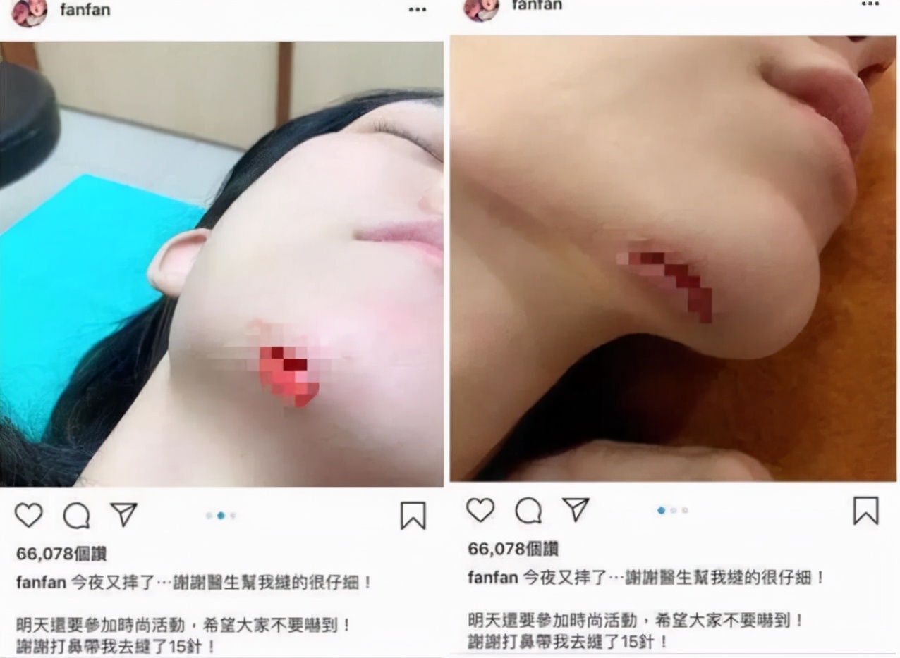 范玮琪经历了哪些事,范玮琪到底经历了什么