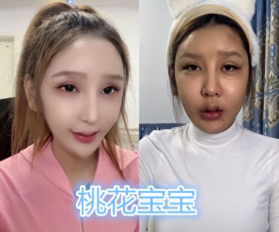 网红整容毁容真实案例,各大网红整容之后的后果