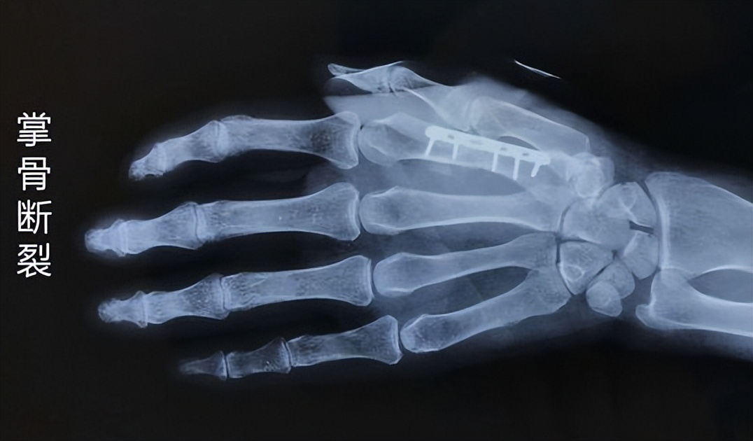 女钢琴老师被打,女钢琴老师被打后续