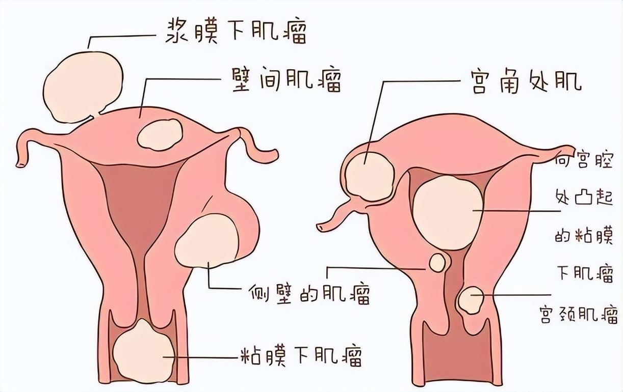 一紧张就想上厕所，是怎么回事？请收下这篇科普