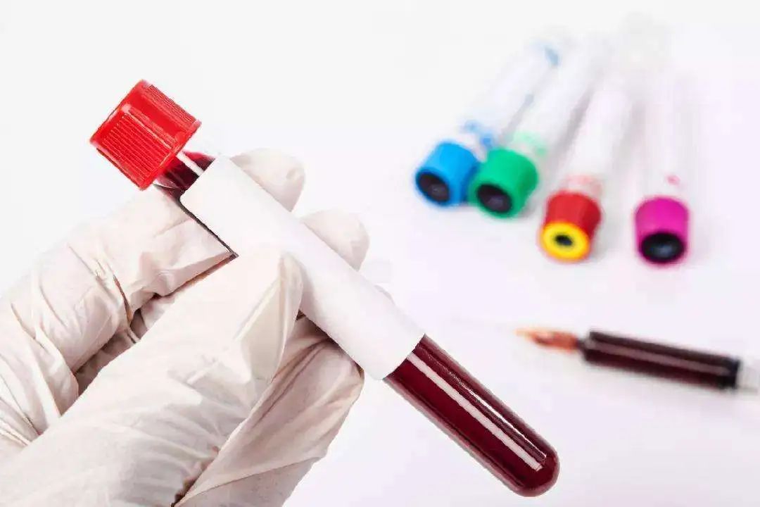 头晕贫血是巨幼细胞性贫血吗,头晕无力发虚是贫血吗