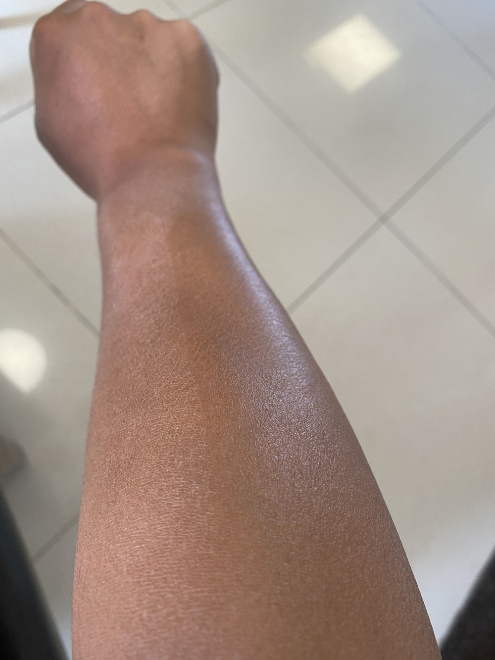 洗完澡身上痒还起皮是怎么回事,洗完澡皮肤干燥起皮浑身痒