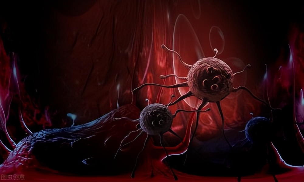 癌症的几个阶段和治疗方式,癌症全身治疗有哪些