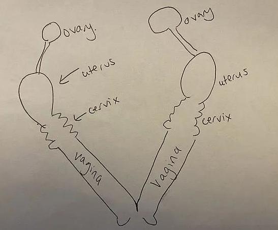 “我有两个*处私**：左边的用来接客，右边的男友专用……”