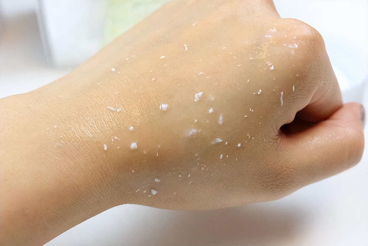 为什么有些人一晒就特别容易黑,为什么夏天有人特别容易被晒黑