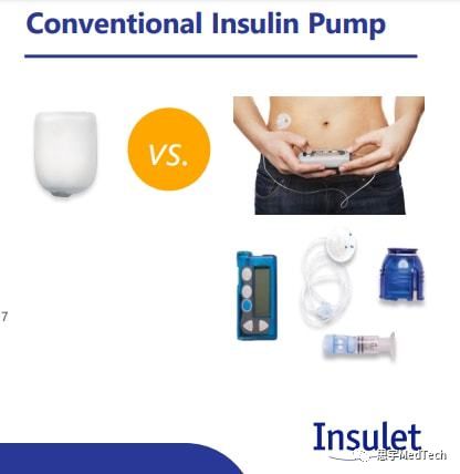 五代无管路自动胰岛素泵,进口最先进的胰岛素泵